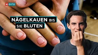 In 3 Wochen kein Nägelkauen mehr: Was wirklich hilft | MEINS Reportage