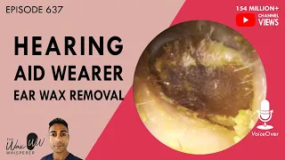 637 - Hearing Aid Wearer Ear Wax Removal