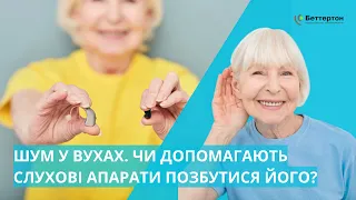 Слухові апарати, які допомагають позбутися шуму у вухах: Starkey Multiflex Tinnitus