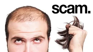 The Billion Dollar Balding Scam