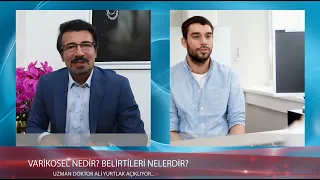 VARİKOSEL NEDİR? BELİRTİLERİ NELERDİR? NASIL TEDAVİ EDİLİR?