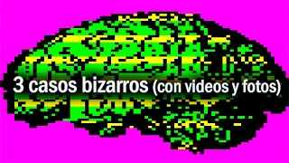 3 CASOS BIZARROS (Con Videos y Fotos)