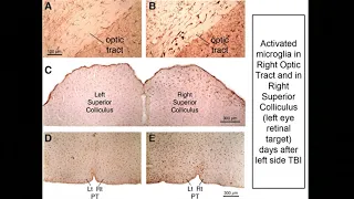 Use of CB2 Receptor Inverse Agonists in the Treatment of Traumatic Brain Injury - Anton Reiner