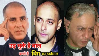 गंजापन छुपाने के लिए नकली बाल लगाते है Bollywood के ये 10 Superstar | 10 Actors hair transplant, Wig