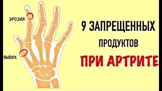 Эти 9 продуктов — могут разрушить суставы! Врачи настоятельно рекомендуют сменить их