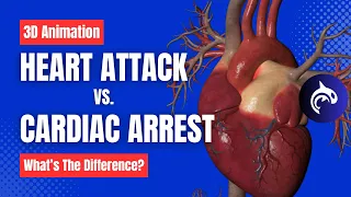 Cardiac Arrest vs Heart Attacks - What's the Difference? - 3D Animation