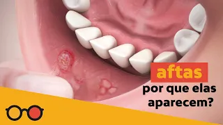 Aftas: por que elas aparecem? | plantão de dúvidas