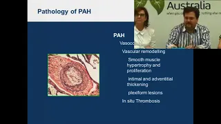 Webinar 1: Managing Pulmonary Arterial Hypertension