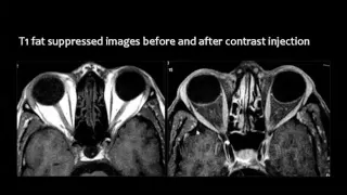 Imaging of Orbit   Dr Mamdouh Mahfouz