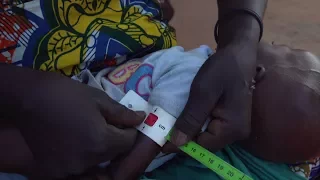 How a coloured band is saving children’s lives in the Sahel