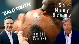 Is Hair Transplant Surgery Now A Scam?  - The Bald Truth - March 15th, 2024