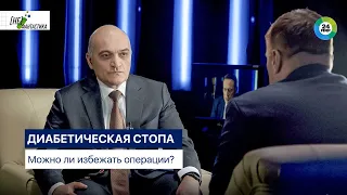 Диабетическая стопа – можно ли избежать операции?