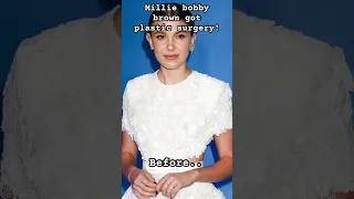 Millie bobby brown got plastic surgery! Before and after 😭😔 remember to subscribe 👌 #millie