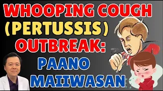 Whooping Cough (Pertussis) Outbreak: Paano Maiiwasan. Tips By Doc Willie Ong