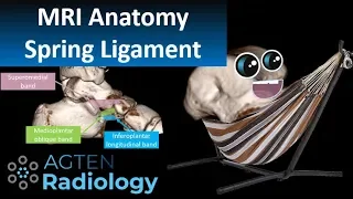 Spring Ligament Complex MRI Anatomy