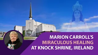 Marion Carroll's Miraculous Healing at Knock Shrine, Ireland | Mary My Mother | Spotlight