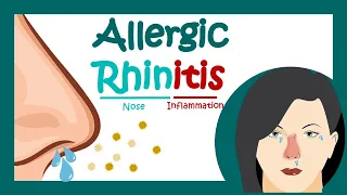 Allergic rhinitis | What is Allergic Rhinitis? | What is the main cause of allergic rhinitis?