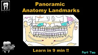 Panoramic Radiography landmark/Orthopantomogram(OPG)Anatomical Landmark/Dental Exam/Dental Radiology
