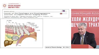Оконтуривание при раке пищевода – мастер-класс для лучевых терапевтов