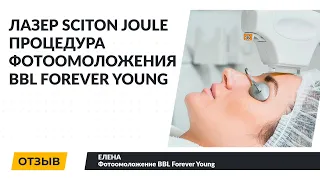 Лазер Sciton Joule модуль BBL Forever Young | Процедура фотоомоложения | Отзыв пациента