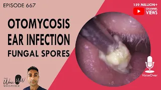 667 - Otomycosis Ear Infection Fungal Spores