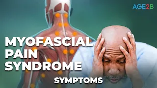Symptoms of Myofascial Pain Syndrome | Animation | How to RELIEVE TRIGGER POINTS