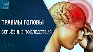 Травмы головы. Серьёзные последствия. На здоровье 10.09.2022