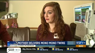 Mother's pregnancy journey with Mono Mono twins - Medical Minute