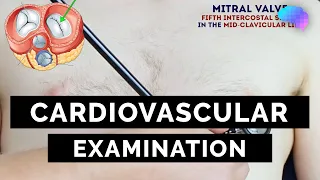 Cardiovascular Examination - OSCE Guide