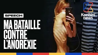 À 20 ans, elle ne pesait plus que 33 kilos. Manon raconte sa bataille contre l'anorexie | Konbini