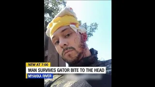 Gator bites man's head in the Myakka River