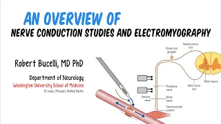 An Overview of Nerve Conduction Studies and Electromyography (Feat. Dr. Bucelli)