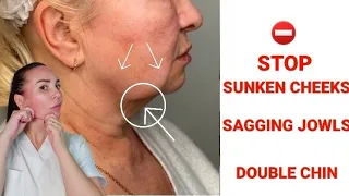 Effective techniques for sagging CHEEKS and SAGGINGJOWLS, DOUBLE CHIN, TURKEY NECK