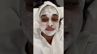 Trying Microneedling To Get Rid Of Acne Scars