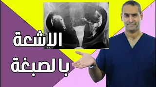 الاشعة بالصبغة, طريقتها, خطورتها و الاستفادة منها - د. احمد حسين