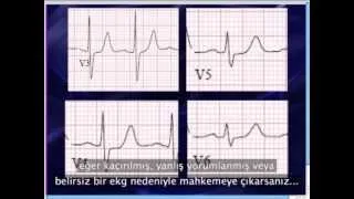Mattu EKG Vakası - Türkçe Altyazılı - 29 Nisan 2013
