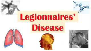 Legionnaires’ Disease | Causes, Pathophysiology, Symptoms, Diagnosis, Treatment