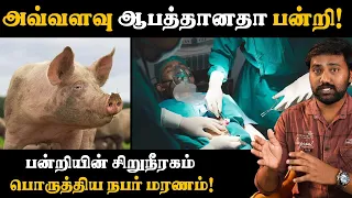 ஏன் பன்றியைத் தேர்ந்தெடுத்தார்கள் தெரியுமா? Xenotransplant tamil | Pig kidney transplant Uyirmei 76