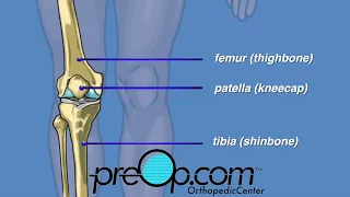 Knee Replacement Surgery: All You Need To Know 🏥🔧 #PreOp #SurgeryTips | PreOp® Patient Education