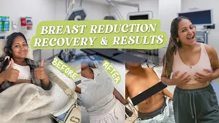 Breast Reduction & Lift Recovery Vlog + RESULTS | DDD to C Cup | Westlake Dermatology Dr. Chike Obi