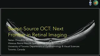 AAO 2018   “Swept Source OCT  Next Frontier in Retinal Imaging”