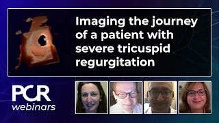 Imaging the journey of a patient with severe tricuspid regurgitation - Webinar