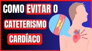 EXAMES QUE PODEM EVITAR UM CATETERISMO CARDÍACO | CINEANGIOCORONARIOGRAFIA