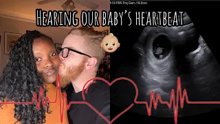 HEARING OUR BABY’S HEARTBEAT FOR THE FIRST TIME 👶🏼💗