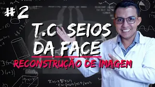 AULA DE TOMOGRAFIA DE SEIOS DA FACE #2 (RECONSTRUÇÃO DE IMAGEM) #RADIOLOGIA