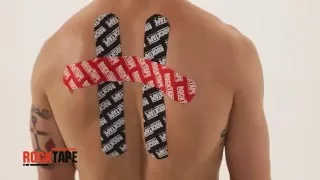 Тейпирование грудного отдела спины от RockTape