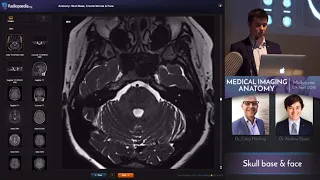 Skull Base and face anatomy for Radiologists | Anuj Aggarwal