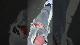 20mph Electric skateboard Slam / Crash