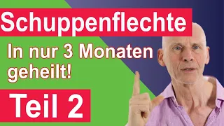 Schuppenflechte Teil2