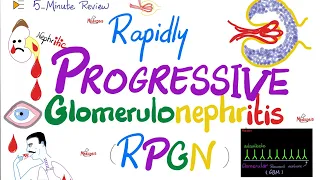 Rapidly Progressive Glomerulonephritis (RPGN) | Cresenteric | Nephritic Syndrome Subtypes